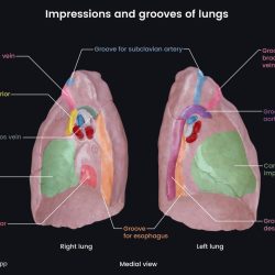 Cardiac impression vs cardiac notch