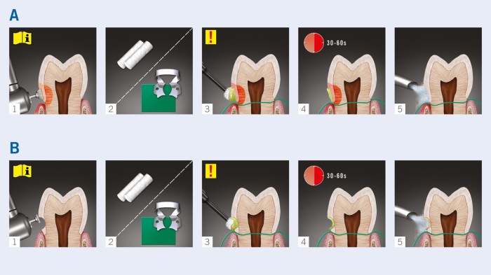 Gluma desensitizer instructions for use