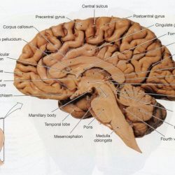 Sheep brain midsagittal view labeled