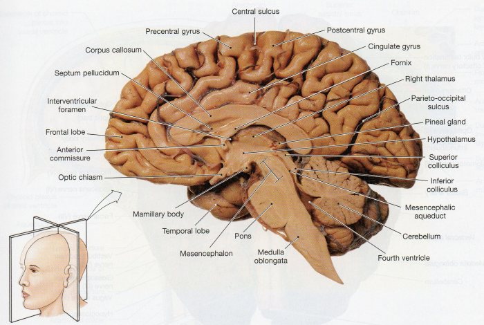 Sheep brain midsagittal view labeled