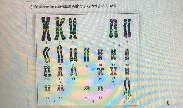 Describe an individual with the karyotype shown.