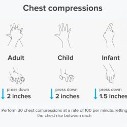 Cpr compressions steps resuscitation cardiopulmonary visual infant adults medicalnewstoday breaths proper cardiac teknik eriksen arrest disambiguation nursing bola darurat mengenal