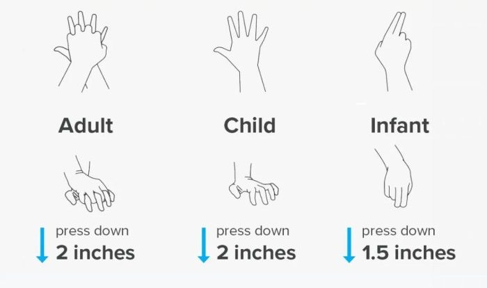 Cpr compressions steps resuscitation cardiopulmonary visual infant adults medicalnewstoday breaths proper cardiac teknik eriksen arrest disambiguation nursing bola darurat mengenal