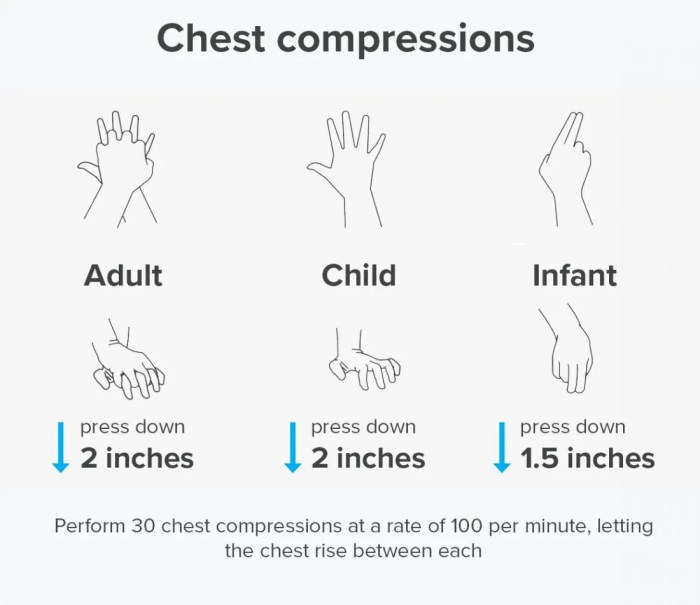 Cpr compressions steps resuscitation cardiopulmonary visual infant adults medicalnewstoday breaths proper cardiac teknik eriksen arrest disambiguation nursing bola darurat mengenal