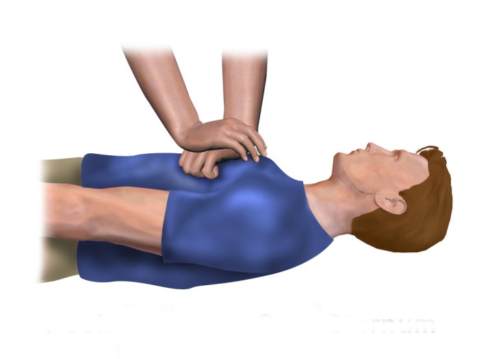 Which technique should susan use to give compressions to noah