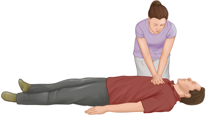 Which technique should susan use to give compressions to noah